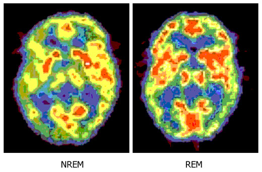 Brains Active During REM